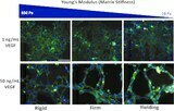 3.Vascular Endothelial Growth Factor and Substrate Mechanics Regulate in vitro Tubulogenesis of Endothelial Progenitor Cells